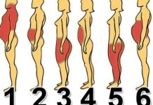 Od čega dolazi VAŠ problem s težinom i šta tačno napraviti: Pronađite svoj tip na ovoj mapi! Od čega dolazi VAŠ problem s težinom i šta tačno napraviti: Pronađite svoj tip na ovoj mapi! - featured image