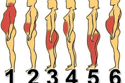 Od čega dolazi VAŠ problem s težinom i šta tačno napraviti: Pronađite svoj tip na ovoj mapi! Od čega dolazi VAŠ problem s težinom i šta tačno napraviti: Pronađite svoj tip na ovoj mapi! - featured image