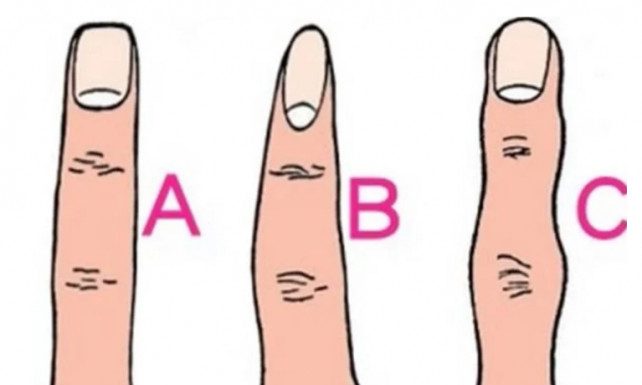 Kakvi prsti takvi ste ljudi: Oblik prstiju može otkriti mnogo toga skrivenog o vama Kakvi prsti takvi ste ljudi: Oblik prstiju može otkriti mnogo toga skrivenog o vama - featured image