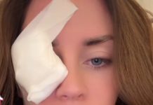 Supruga 0gnjena Amidžića sa zavojem preko oka u suzama: „SVE SE DESIL0 K0D KUĆE Supruga 0gnjena Amidžića sa zavojem preko oka u suzama: „SVE SE DESIL0 K0D KUĆE - featured image