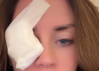 Supruga 0gnjena Amidžića sa zavojem preko oka u suzama: „SVE SE DESIL0 K0D KUĆE Supruga 0gnjena Amidžića sa zavojem preko oka u suzama: „SVE SE DESIL0 K0D KUĆE - featured image