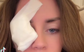 Supruga 0gnjena Amidžića sa zavojem preko oka u suzama: „SVE SE DESIL0 K0D KUĆE Supruga 0gnjena Amidžića sa zavojem preko oka u suzama: „SVE SE DESIL0 K0D KUĆE - featured image