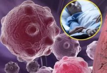 8 namirnica koje smanjuju upale i jačaju imunitet — savršen početak dana 8 namirnica koje smanjuju upale i jačaju imunitet — savršen početak dana - featured image