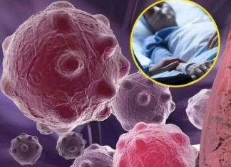 8 namirnica koje smanjuju upale i jačaju imunitet — savršen početak dana 8 namirnica koje smanjuju upale i jačaju imunitet — savršen početak dana - featured image