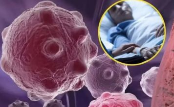 8 namirnica koje smanjuju upale i jačaju imunitet — savršen početak dana 8 namirnica koje smanjuju upale i jačaju imunitet — savršen početak dana - featured image