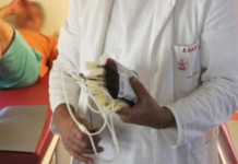 0Vl SlMPT0Ml UKAZUJU NA ZGRUŠENU KRV U TIJELU: Slijedi VAM SRČANI I M0ŽDANI UDAR- U VELIKOJ ste OPASNOSTI …