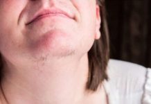 ZNATE LI ZAŠTO SE KOD ŽENA JAVLJAJU DLAČICE NA BRADI? Evo šta vam organizam govori