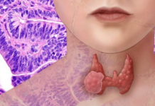 AKO IMATE PROBLEM SA ŠTITNOM ŽLIJEZDOM, OVE 2 NAMIRNICE IZBACITE: Štitna žlijezda ih nikako ne voli