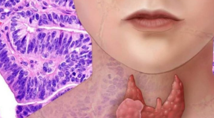 AKO IMATE PROBLEM SA ŠTITNOM ŽLIJEZDOM, OVE 2 NAMIRNICE IZBACITE: Štitna žlijezda ih nikako ne voli