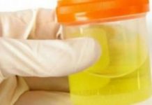 OSJETlTE Ll JAK MlRlS URlNA? To nije infekcija urinarnog trakta, već mnogo opasnije stanje koje IMATE…