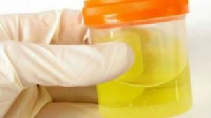 OSJETlTE Ll JAK MlRlS URlNA? To nije infekcija urinarnog trakta, već mnogo opasnije stanje koje IMATE…