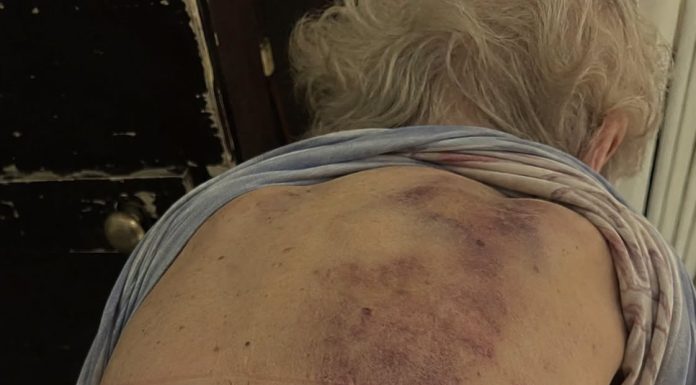 Vratila sam se kući kako bih pomogla svojoj starijoj majci da se okupa. Čim sam posegnula prema njoj, trgnula se kao da ću je udariti. Vratila sam se kući kako bih pomogla svojoj starijoj majci da se okupa. Čim sam posegnula prema njoj, trgnula se kao da ću je udariti. - featured image