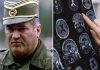 Sve bolesti od kojih je bolovao Ratko Mladić: Ovi simptomi ne smeju da se ignorišu, mogu biti kobni Sve bolesti od kojih je bolovao Ratko Mladić: Ovi simptomi ne smeju da se ignorišu, mogu biti kobni - featured image