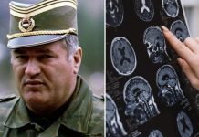 Sve bolesti od kojih je bolovao Ratko Mladić: Ovi simptomi ne smeju da se ignorišu, mogu biti kobni Sve bolesti od kojih je bolovao Ratko Mladić: Ovi simptomi ne smeju da se ignorišu, mogu biti kobni - featured image