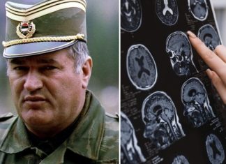 Sve bolesti od kojih je bolovao Ratko Mladić: Ovi simptomi ne smeju da se ignorišu, mogu biti kobni Sve bolesti od kojih je bolovao Ratko Mladić: Ovi simptomi ne smeju da se ignorišu, mogu biti kobni - featured image