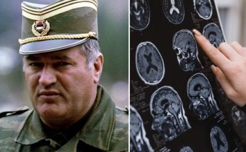 Sve bolesti od kojih je bolovao Ratko Mladić: Ovi simptomi ne smeju da se ignorišu, mogu biti kobni Sve bolesti od kojih je bolovao Ratko Mladić: Ovi simptomi ne smeju da se ignorišu, mogu biti kobni - featured image