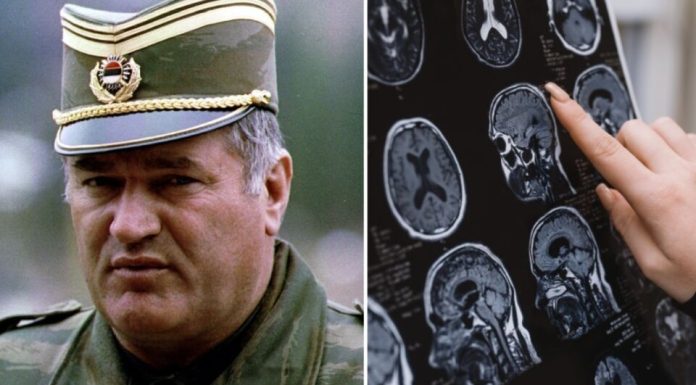 Sve bolesti od kojih je bolovao Ratko Mladić: Ovi simptomi ne smeju da se ignorišu, mogu biti kobni Sve bolesti od kojih je bolovao Ratko Mladić: Ovi simptomi ne smeju da se ignorišu, mogu biti kobni - featured image