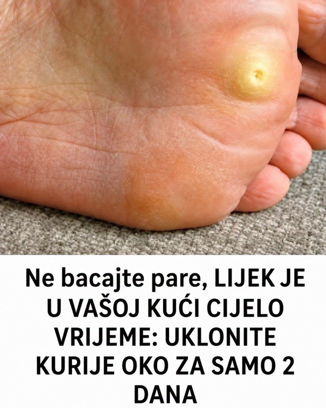 UKLONITE KURIJE OKO ZA SAMO 2 DANA: Ne bacajte pare, LIJEK JE U VAŠOJ KUĆI CIJELO VRIJEME - featured image UKLONITE KURIJE OKO ZA SAMO 2 DANA: Ne bacajte pare, LIJEK JE U VAŠOJ KUĆI CIJELO VRIJEME - featured image