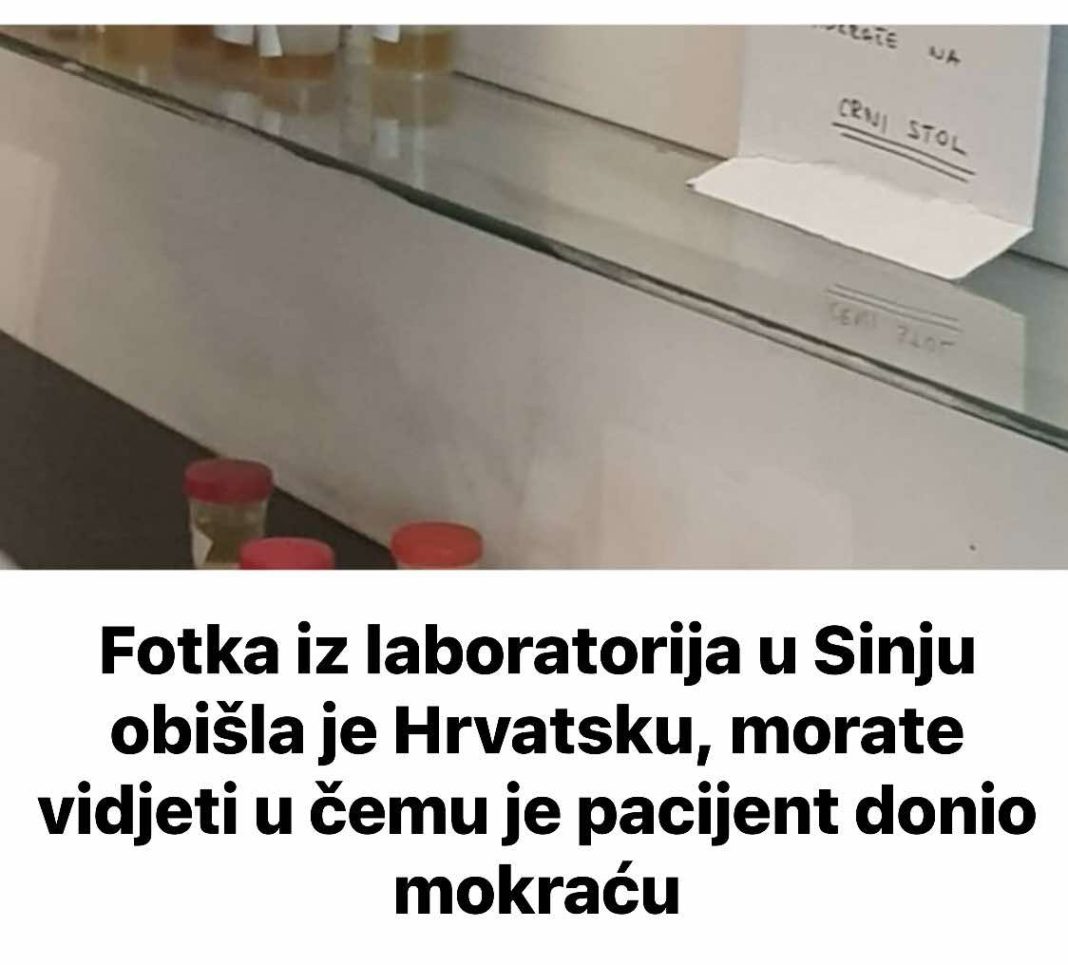 Fotka iz laboratorija u Sinju obišla je Hrvatsku, morate vidjeti u čemu je pacijent donio mokraću - featured image