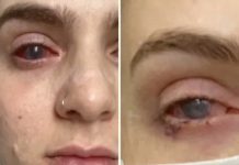 Popila tabletu protiv bolova koju uzimaju mnogi, a onda joj se život zauvijek promijenio Popila tabletu protiv bolova koju uzimaju mnogi, a onda joj se život zauvijek promijenio - featured image