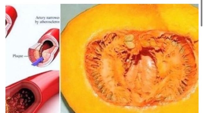 I DOKTORI GA KORISTE: Uz ovaj recept recite ZBOGOM povišenom holesterolu, šećeru u krvi, masnoćama i trigliceridima! I DOKTORI GA KORISTE: Uz ovaj recept recite ZBOGOM povišenom holesterolu, šećeru u krvi, masnoćama i trigliceridima! - featured image