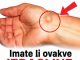 IMATE LI OVAKVE IZRASLINE: Evo kako da ih se riješite PREKO NOĆI IMATE LI OVAKVE IZRASLINE: Evo kako da ih se riješite PREKO NOĆI - featured image