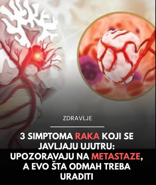 NE IGNORIŠITE IH: Možda su neprijatni, ali ovo su prvi simptomi raka debelog crijeva - featured image NE IGNORIŠITE IH: Možda su neprijatni, ali ovo su prvi simptomi raka debelog crijeva - featured image