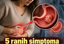 5 ranih simptoma raka želuca: Tumor može da raste godinama, a svi pacijenti prvo osjete ovo 5 ranih simptoma raka želuca: Tumor može da raste godinama, a svi pacijenti prvo osjete ovo - featured image