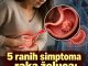 5 ranih simptoma raka želuca: Tumor može da raste godinama, a svi pacijenti prvo osjete ovo 5 ranih simptoma raka želuca: Tumor može da raste godinama, a svi pacijenti prvo osjete ovo - featured image