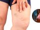 Simptomi krvnih ugrušaka u tijelu: Ako to primijetite, odmah potražite medicinsku pomoć Simptomi krvnih ugrušaka u tijelu: Ako to primijetite, odmah potražite medicinsku pomoć - featured image