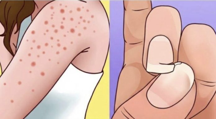 Simptomi koje ne treba ignorisati: Stručnjaci upozoravaju na moguće rane znakove ozbiljnih bolesti Simptomi koje ne treba ignorisati: Stručnjaci upozoravaju na moguće rane znakove ozbiljnih bolesti - featured image