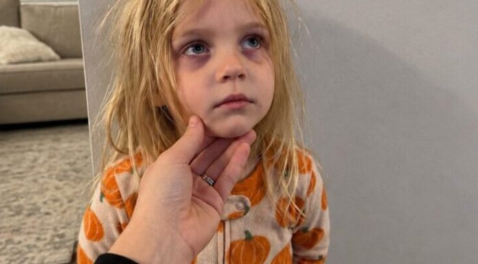 🥺👉💔 „TATA, MOLIM TE, NEMOJ ME SUTRA VODITI U ŠKOLU…“ Mislio sam da moja šestogodišnja kći jednostavno ne želi ići u školu. Ali jedne večeri primijetio sam tamni trag na njezinoj ruci. Pokušala ga je sakriti, a onda me pogledala ravno u oči i rekla nešto zbog čega sam samo sjeo na pod i zaplakao… 😨👇‼️ 🥺👉💔 „TATA, MOLIM TE, NEMOJ ME SUTRA VODITI U ŠKOLU…“ Mislio sam da moja šestogodišnja kći jednostavno ne želi ići u školu. Ali jedne večeri primijetio sam tamni trag na njezinoj ruci. Pokušala ga je sakriti, a onda me pogledala ravno u oči i rekla nešto zbog čega sam samo sjeo na pod i zaplakao… 😨👇‼️ - featured image